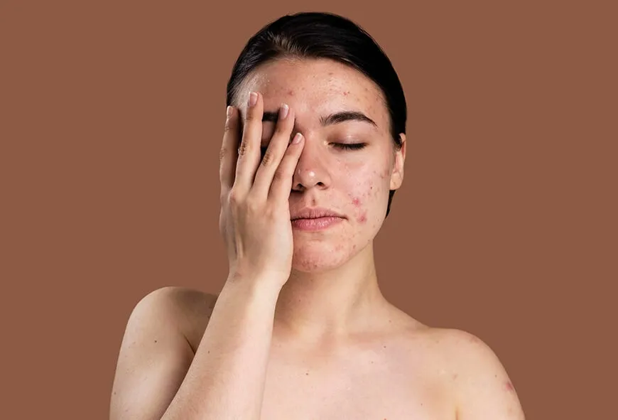 Leke Bakım Protokolü